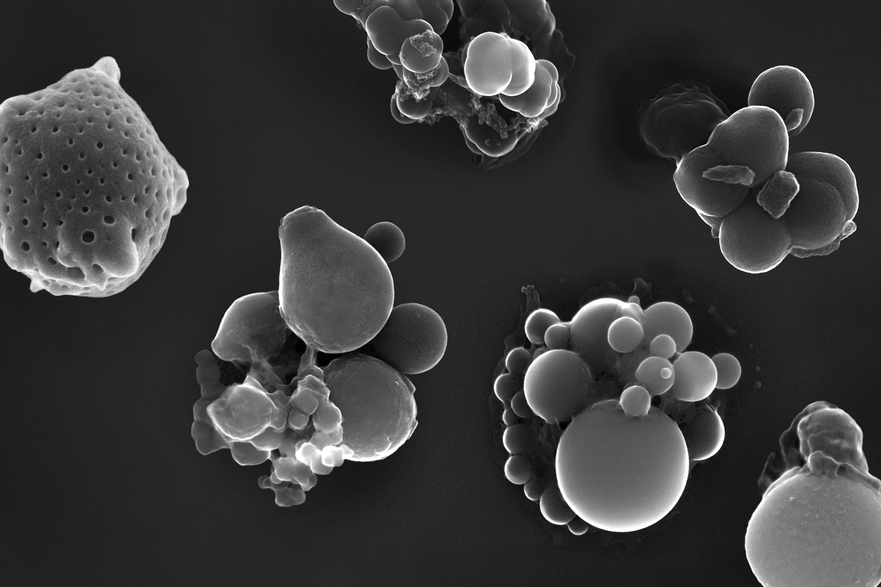 Airborne Particles as seen under a scanning electron microscope